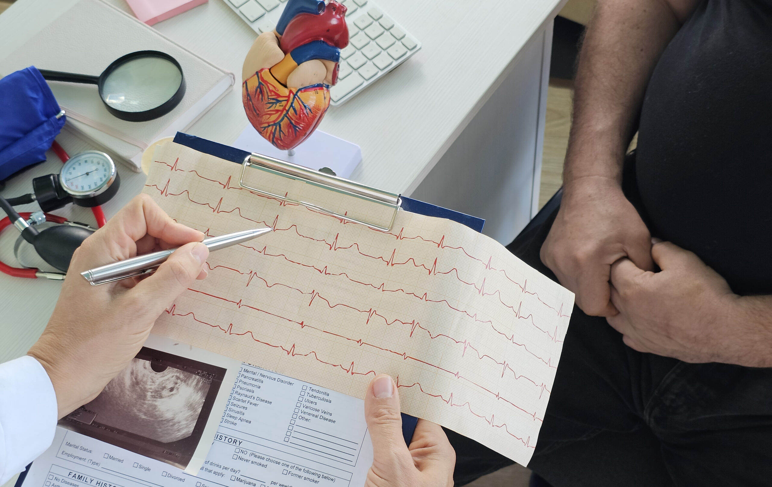 Ręce lekarza wskazujące wykres elektrokardiogramu, w tle pacjent z podejrzeniem arytmii serca oraz przybory medyczne
